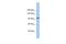 Klotho Beta antibody, A05877, Boster Biological Technology, Western Blot image 