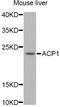 Acid Phosphatase antibody, A12390, ABclonal Technology, Western Blot image 