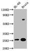FEV Transcription Factor, ETS Family Member antibody, CSB-PA858717LA01HU, Cusabio, Western Blot image 