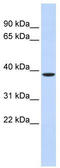 Zinc finger protein-like 1 antibody, TA344459, Origene, Western Blot image 