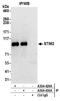 Stromal interaction molecule 2 antibody, A304-430A, Bethyl Labs, Immunoprecipitation image 