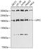 UPF2 Regulator Of Nonsense Mediated MRNA Decay antibody, GTX65934, GeneTex, Western Blot image 