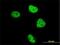 Zinc Finger And BTB Domain Containing 33 antibody, H00010009-M01, Novus Biologicals, Immunocytochemistry image 