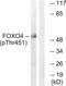 Forkhead Box O4 antibody, LS-C198980, Lifespan Biosciences, Western Blot image 