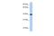 Retinol Dehydrogenase 11 antibody, PA5-43161, Invitrogen Antibodies, Western Blot image 