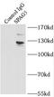 Sperm-associated antigen 5 antibody, FNab08143, FineTest, Immunoprecipitation image 