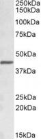 Sterol O-acyltransferase 1 antibody, TA311115, Origene, Western Blot image 