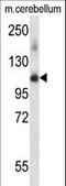Pre-MRNA Processing Factor 4B antibody, LS-C164559, Lifespan Biosciences, Western Blot image 