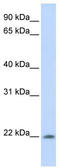 All-Trans Retinoic Acid Induced Differentiation Factor antibody, TA329155, Origene, Western Blot image 
