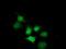Sulfotransferase Family 1A Member 1 antibody, MA5-25297, Invitrogen Antibodies, Immunocytochemistry image 