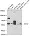 Phosphodiesterase 1B antibody, GTX54568, GeneTex, Western Blot image 