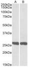 Ubiquitin C-Terminal Hydrolase L1 antibody, AP21292PU-N, Origene, Western Blot image 