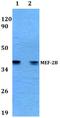 Myocyte Enhancer Factor 2B antibody, PA5-75240, Invitrogen Antibodies, Western Blot image 