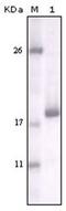 Discoidin Domain Receptor Tyrosine Kinase 2 antibody, AM06186SU-N, Origene, Western Blot image 