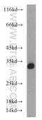 CD82 Molecule antibody, 10248-1-AP, Proteintech Group, Western Blot image 