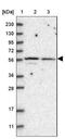 SH3 Domain Binding Protein 2 antibody, NBP1-85458, Novus Biologicals, Western Blot image 