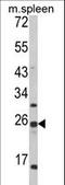 FKBP Prolyl Isomerase 11 antibody, LS-C166161, Lifespan Biosciences, Western Blot image 