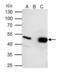 Ubiquinol-Cytochrome C Reductase Core Protein 2 antibody, GTX114873, GeneTex, Immunoprecipitation image 