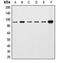 Catenin Beta 1 antibody, MBS820149, MyBioSource, Western Blot image 
