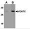 VENT Homeobox antibody, MBS151141, MyBioSource, Western Blot image 
