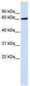 ADAM Metallopeptidase Domain 9 antibody, TA339379, Origene, Western Blot image 