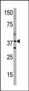 DIMT1 RRNA Methyltransferase And Ribosome Maturation Factor antibody, PA5-11783, Invitrogen Antibodies, Western Blot image 
