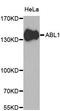 ABL Proto-Oncogene 1, Non-Receptor Tyrosine Kinase antibody, A0282, ABclonal Technology, Western Blot image 