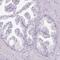 Regulatory Factor X2 antibody, PA5-61850, Invitrogen Antibodies, Immunohistochemistry paraffin image 
