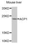 Acid Phosphatase 1 antibody, abx006698, Abbexa, Western Blot image 