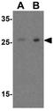 R-Spondin 1 antibody, GTX85282, GeneTex, Western Blot image 
