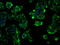 Solute Carrier Family 2 Member 5 antibody, GTX83631, GeneTex, Immunocytochemistry image 