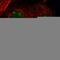 Nucleolin antibody, HPA023981, Atlas Antibodies, Immunocytochemistry image 