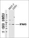 Interferon Alpha 5 antibody, orb157640, Biorbyt, Western Blot image 