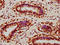 UV Stimulated Scaffold Protein A antibody, orb423024, Biorbyt, Immunohistochemistry paraffin image 