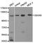 DExD/H-Box Helicase 58 antibody, TA326840, Origene, Western Blot image 
