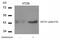 GATA Binding Protein 1 antibody, PA5-37582, Invitrogen Antibodies, Western Blot image 