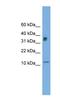 Chromosome 15 Open Reading Frame 40 antibody, NBP1-57041, Novus Biologicals, Western Blot image 
