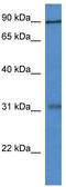 Midline 2 antibody, TA337944, Origene, Western Blot image 