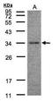 HAD antibody, GTX104402, GeneTex, Western Blot image 