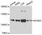Spectrin Repeat Containing Nuclear Envelope Family Member 3 antibody, A13237, ABclonal Technology, Western Blot image 