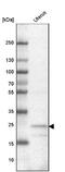 F-Box And Leucine Rich Repeat Protein 22 antibody, NBP2-14011, Novus Biologicals, Western Blot image 