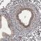 Cytosolic purine 5 -nucleotidase antibody, NBP1-85526, Novus Biologicals, Immunohistochemistry paraffin image 