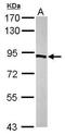 Phosphofructokinase, Platelet antibody, GTX107857, GeneTex, Western Blot image 