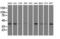 Sterol O-Acyltransferase 2 antibody, LS-C115251, Lifespan Biosciences, Western Blot image 