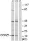 Coatomer Protein Complex Subunit Zeta 1 antibody, TA315182, Origene, Western Blot image 