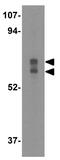 Dihydropyrimidinase-related protein 1 antibody, GTX31723, GeneTex, Western Blot image 