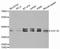 Eukaryotic Translation Elongation Factor 1 Delta antibody, orb167172, Biorbyt, Western Blot image 