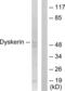 Dyskerin Pseudouridine Synthase 1 antibody, abx013314, Abbexa, Western Blot image 