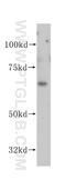 VANGL Planar Cell Polarity Protein 1 antibody, 14696-1-AP, Proteintech Group, Western Blot image 