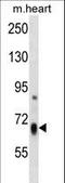 HBS1-like protein antibody, LS-C159811, Lifespan Biosciences, Western Blot image 